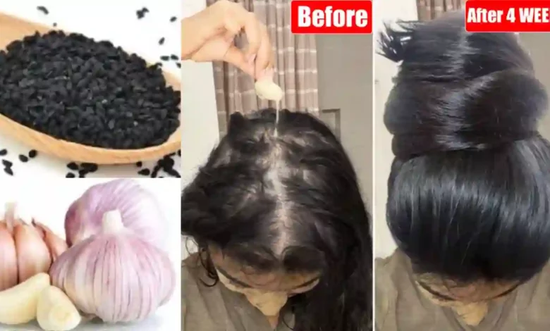 Garlic and Black Seed Hair Oil