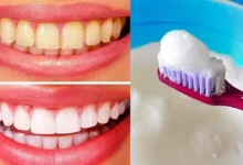 WHITE TEETH IN 2 MINUTES - See How Quick and Easy It Is!
